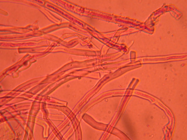 Aphyllo sulle spine (Skeletocutis nivea)